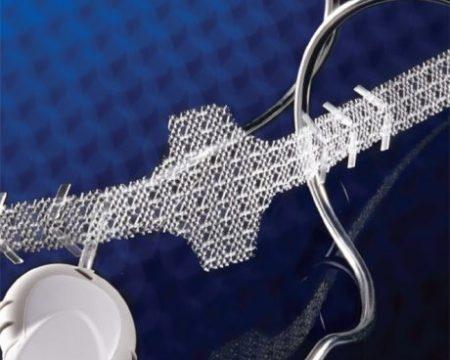 AdVance_XP_Mesh2